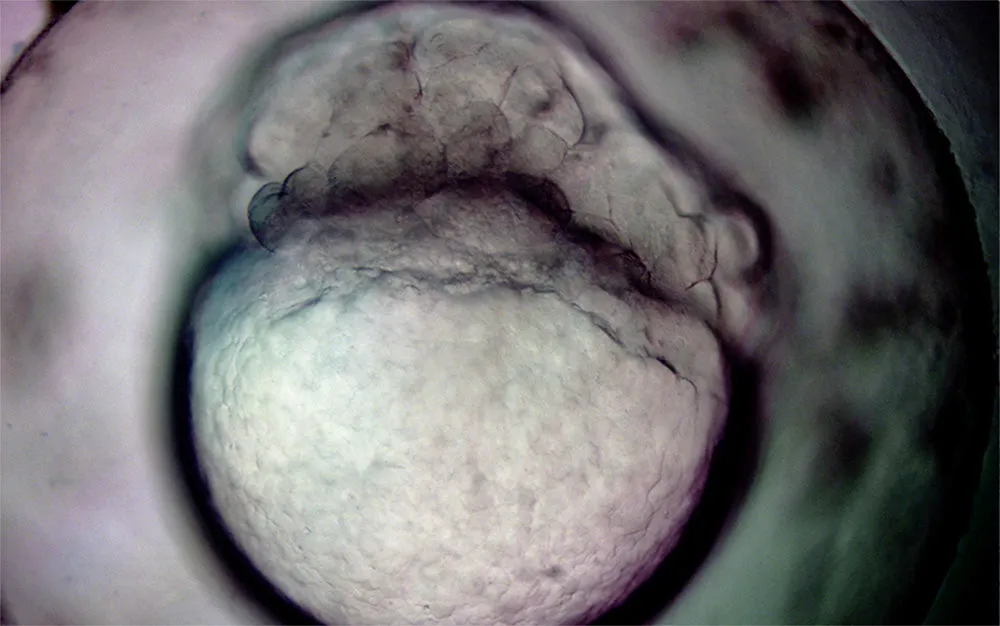 GESTATION by Geraldine Ondrizek