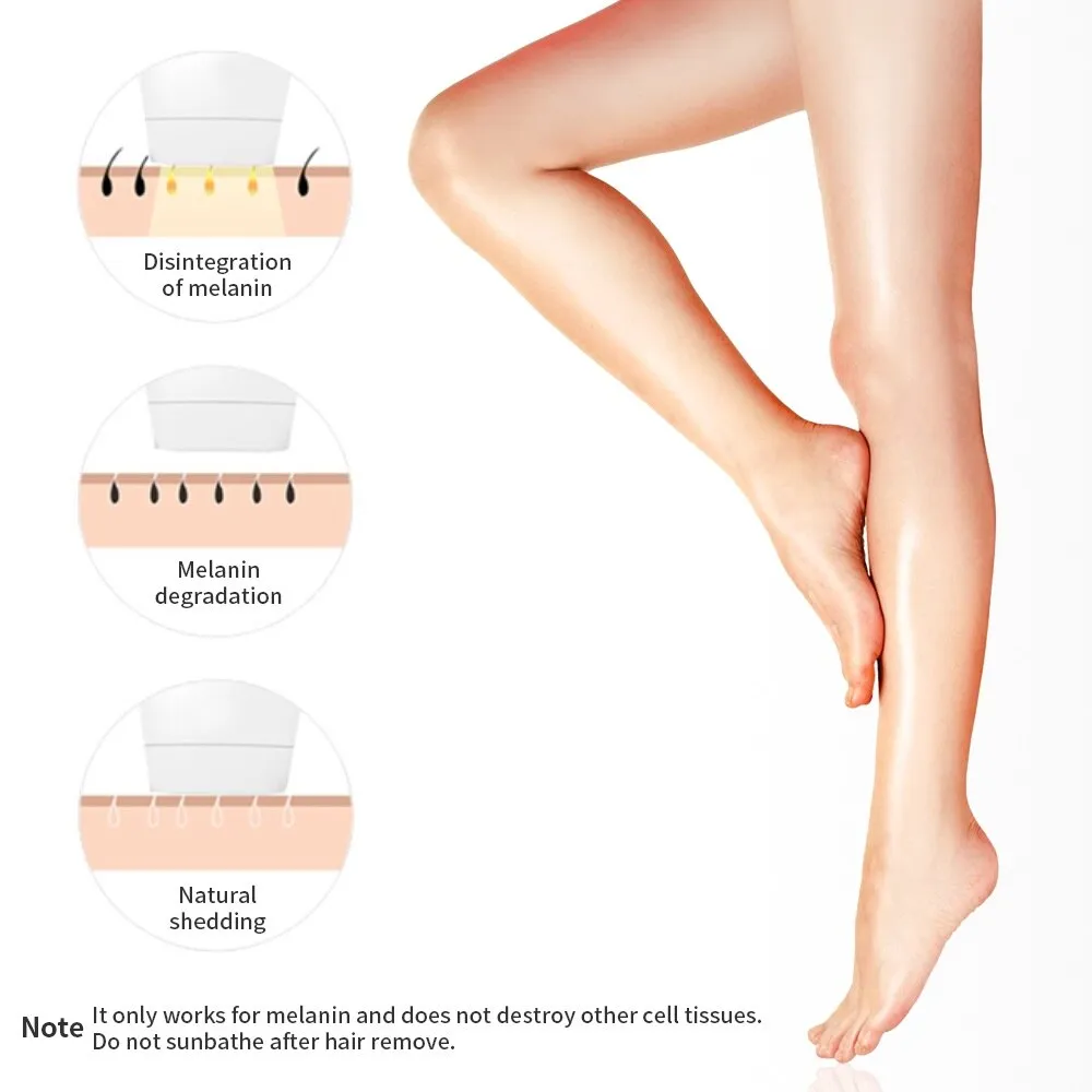 IPL Permanent Laser Hair Removal Machine