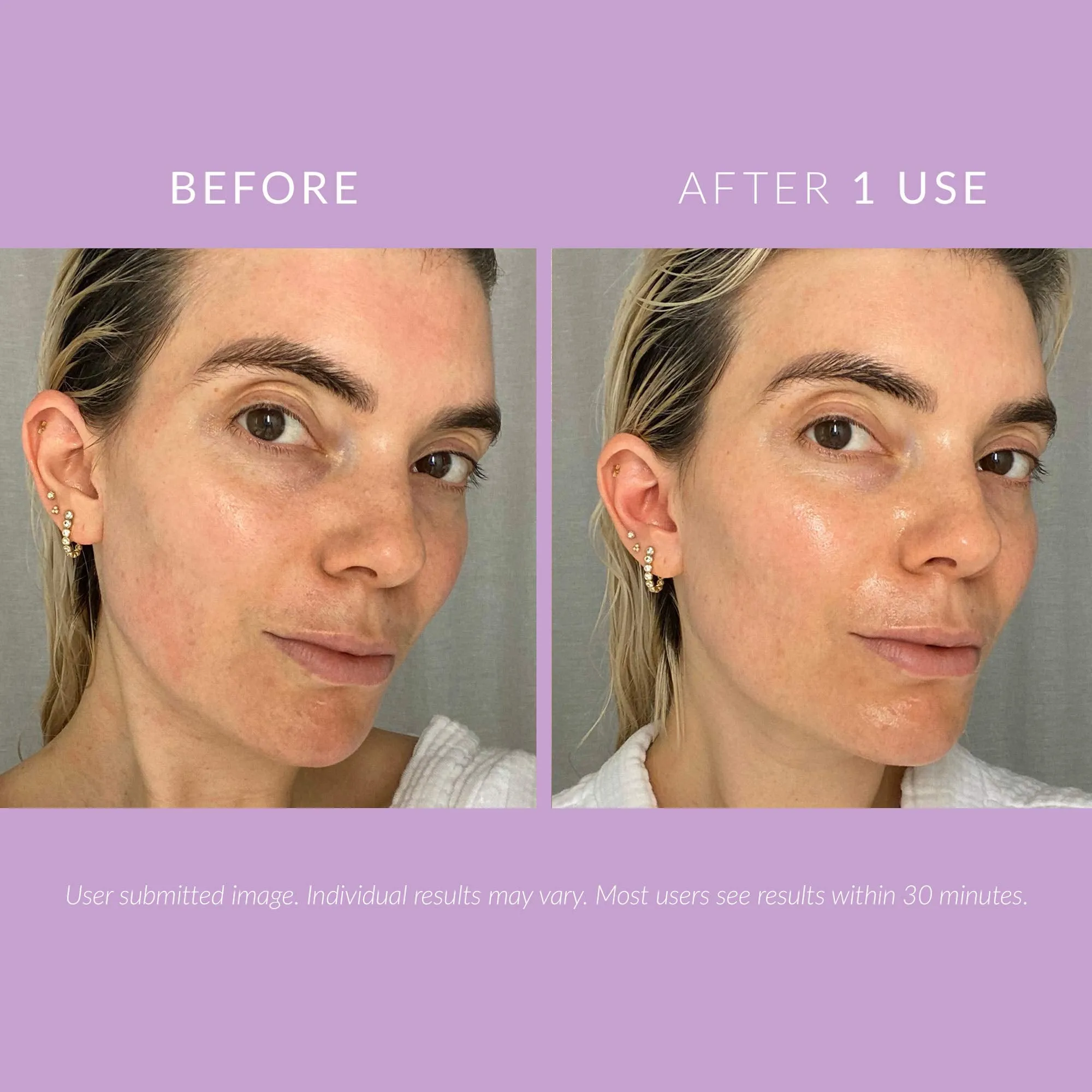 Kate Somerville DeliKate Recovery Cream – Clinically Formulated Hydrating Treatment – Irritation and Redness Relief for Stressed or Sensitive Skin, 1.7 Fl Oz